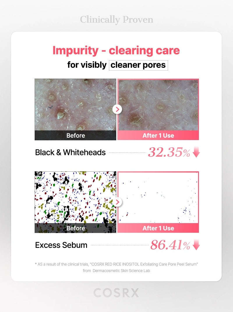 COSRX RED RICE INOSITOL Exfoliating Care Pore Wash-Off Peel Serum